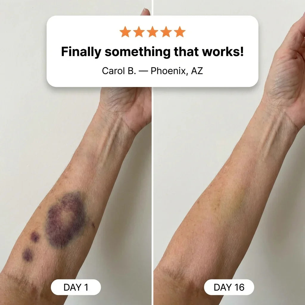Refibi: Bruise Repair & Skin-Strengthening Cream